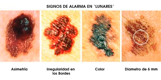 Alarma en Lunares